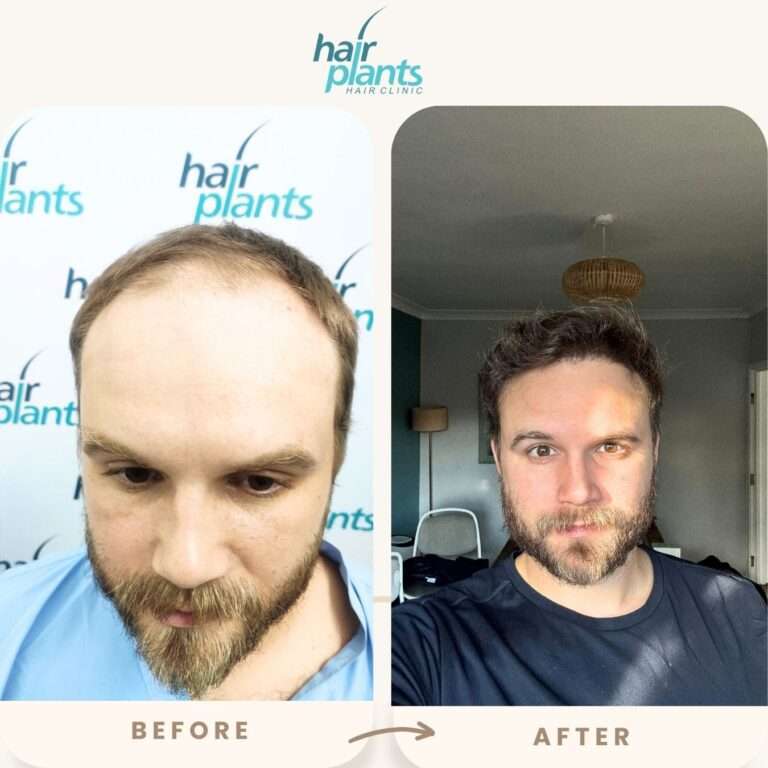 4-month-difference-in-changes