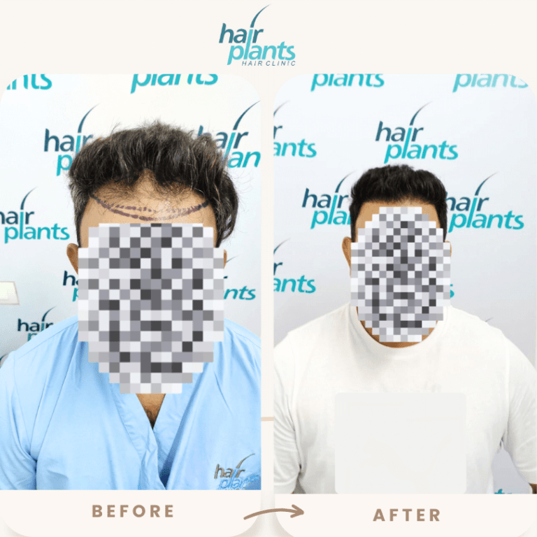 Copy-of-4-month-difference-in-changes-1